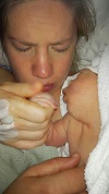 Joshua Philip, baby with anencephaly