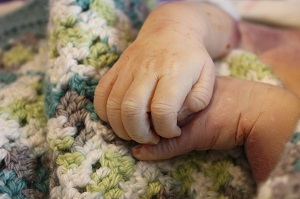 Luke Anderson Wilde, baby with anencephaly