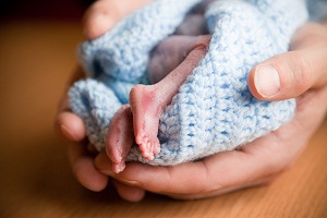 Noah Cutlip, baby with anencephaly