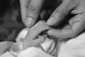 Zak Nathan, baby with anencephaly